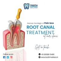 Expert Root Canal Treatment with Zirconia Crown Care | Tooth Matters